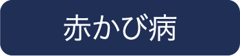 赤かび病